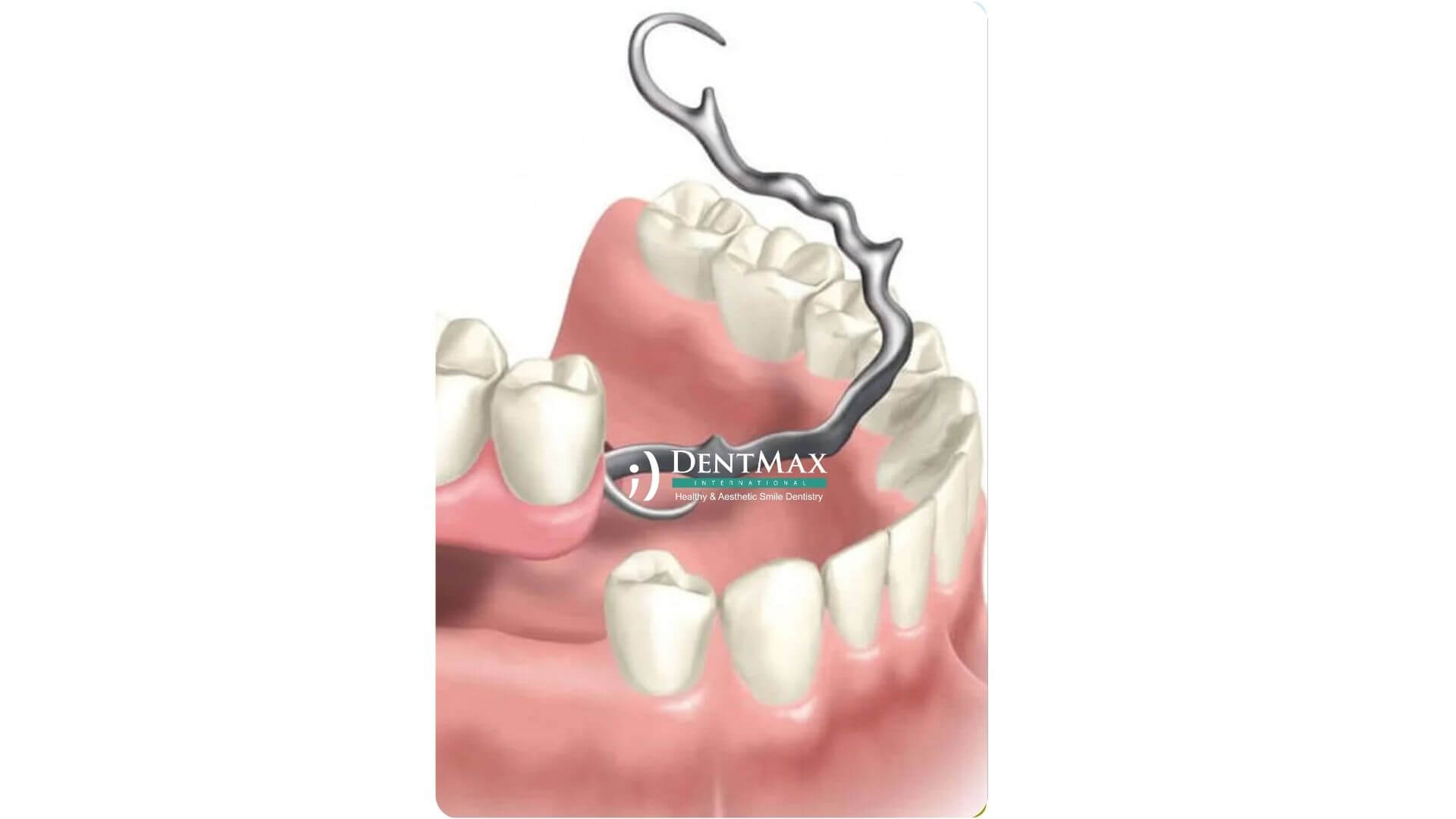 Dentmax Banner