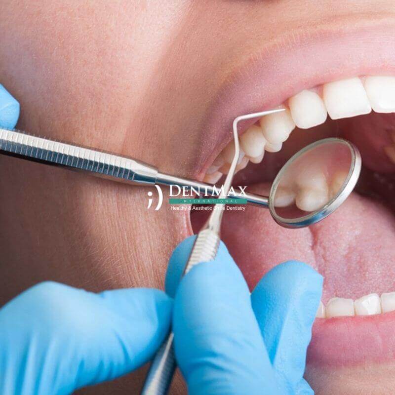 Dentmax Banner