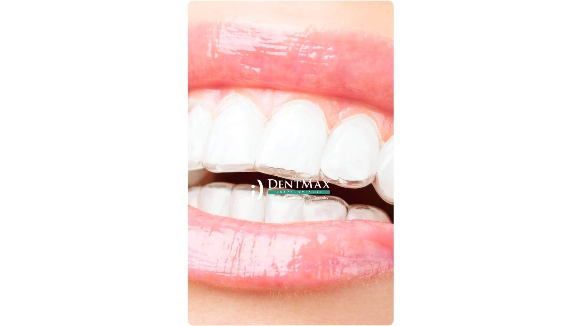 Dentmax Banner