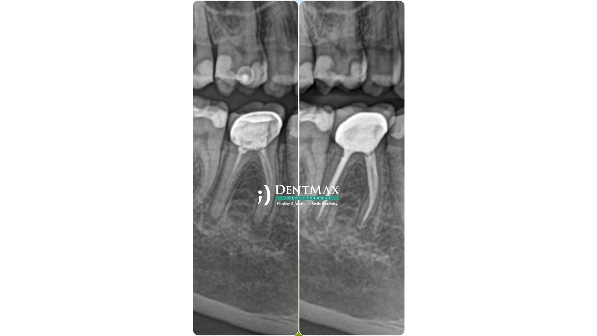 Dentmax Banner