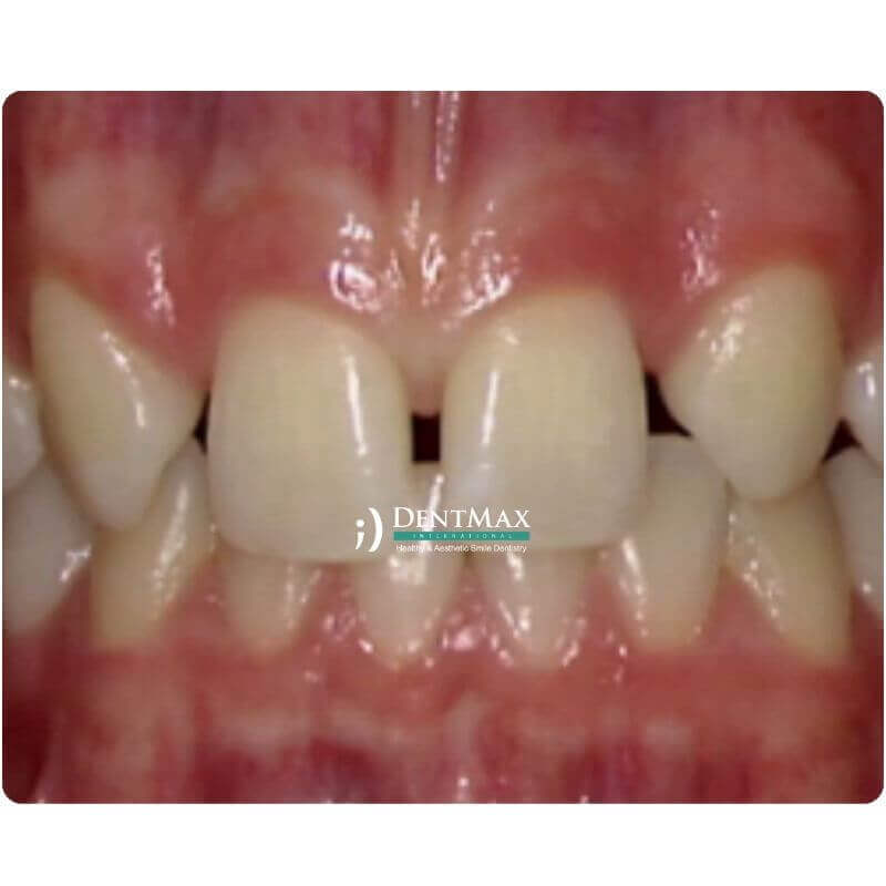 Dentmax Banner