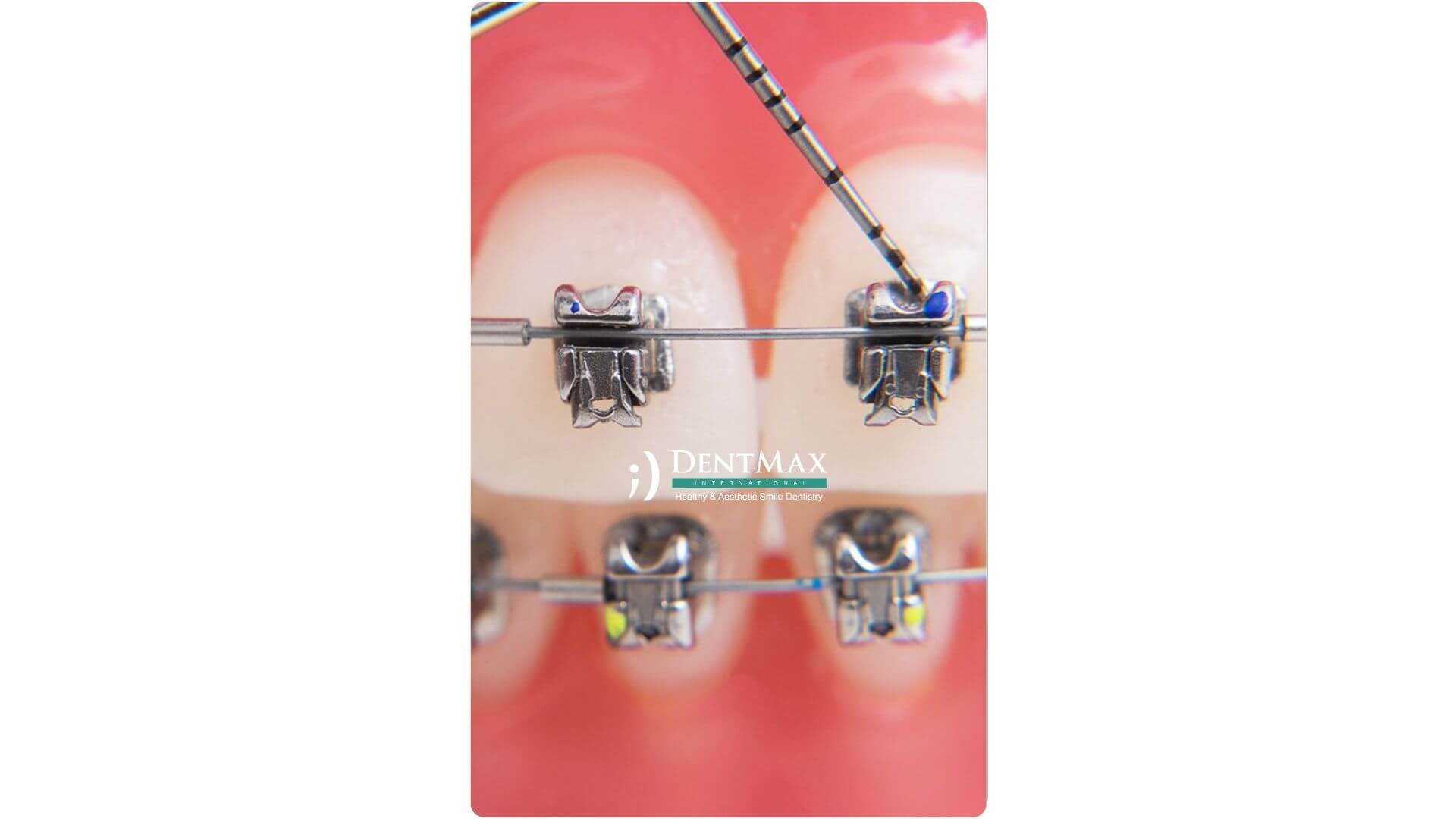Dentmax Banner