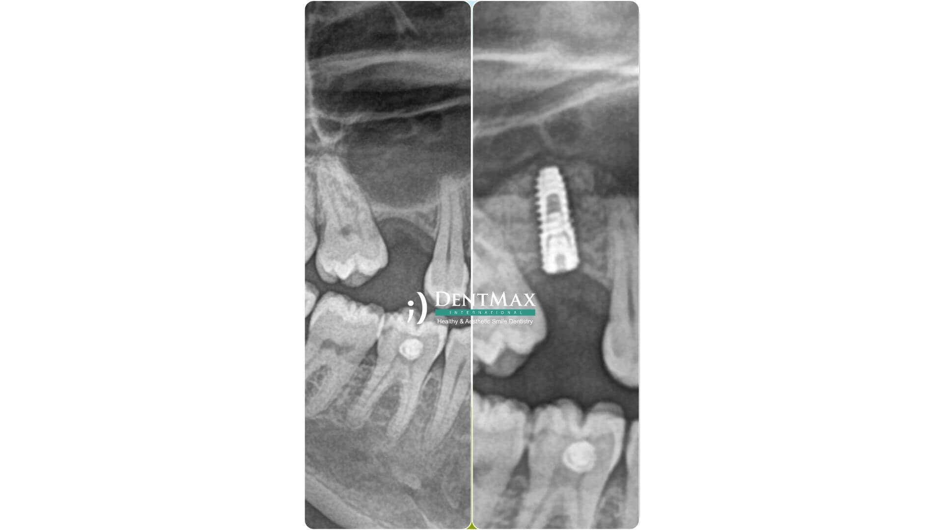Dentmax Banner