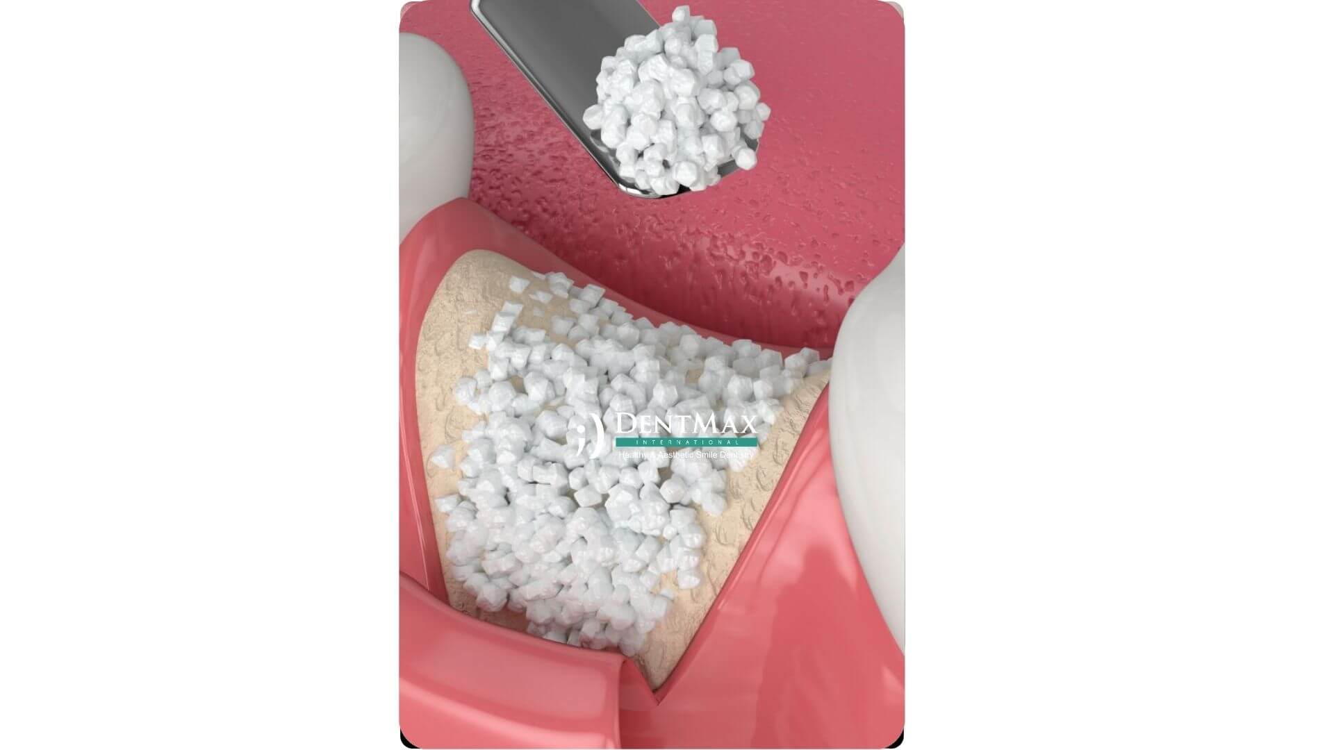 Dentmax Banner