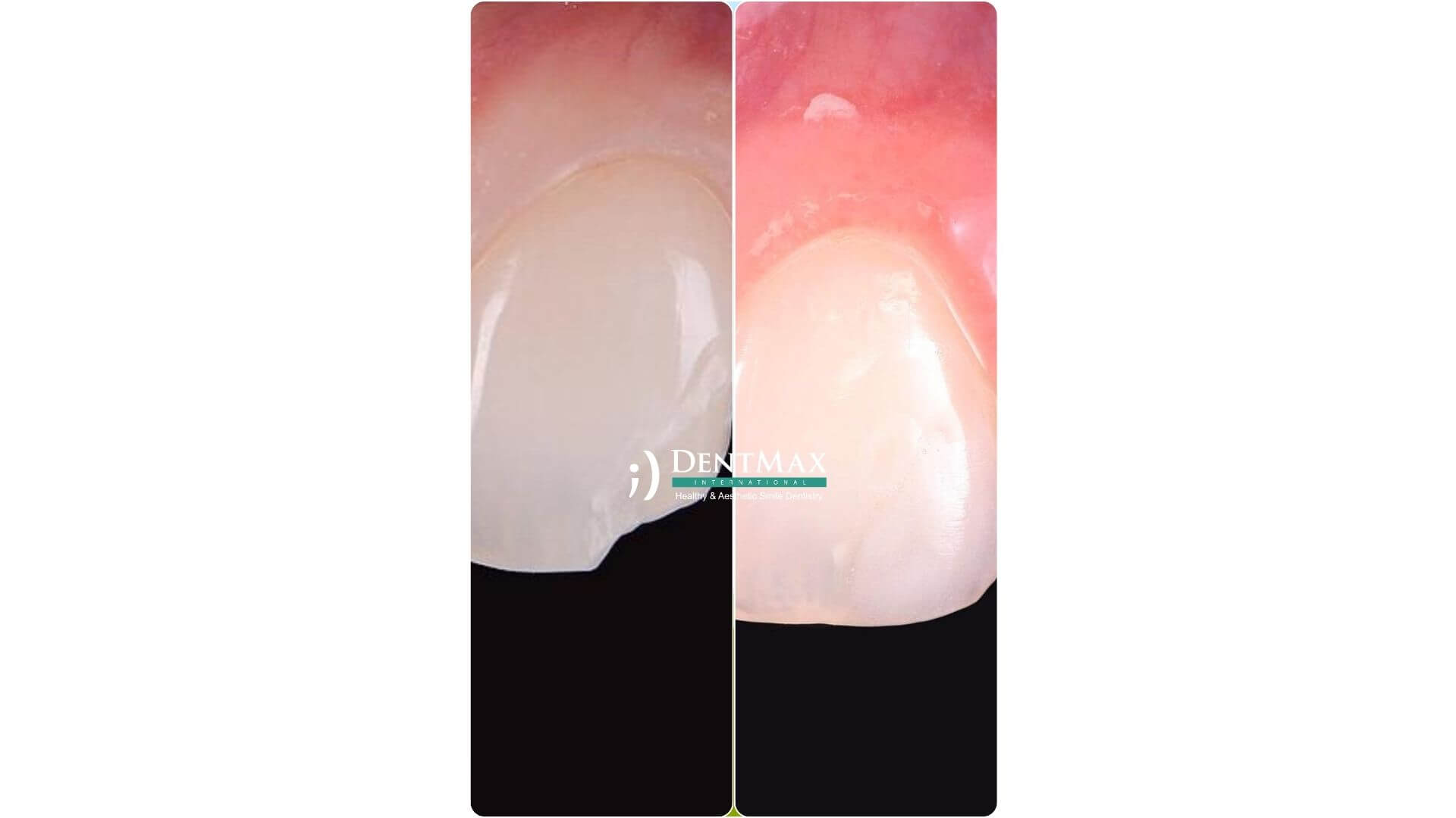 Dentmax Banner