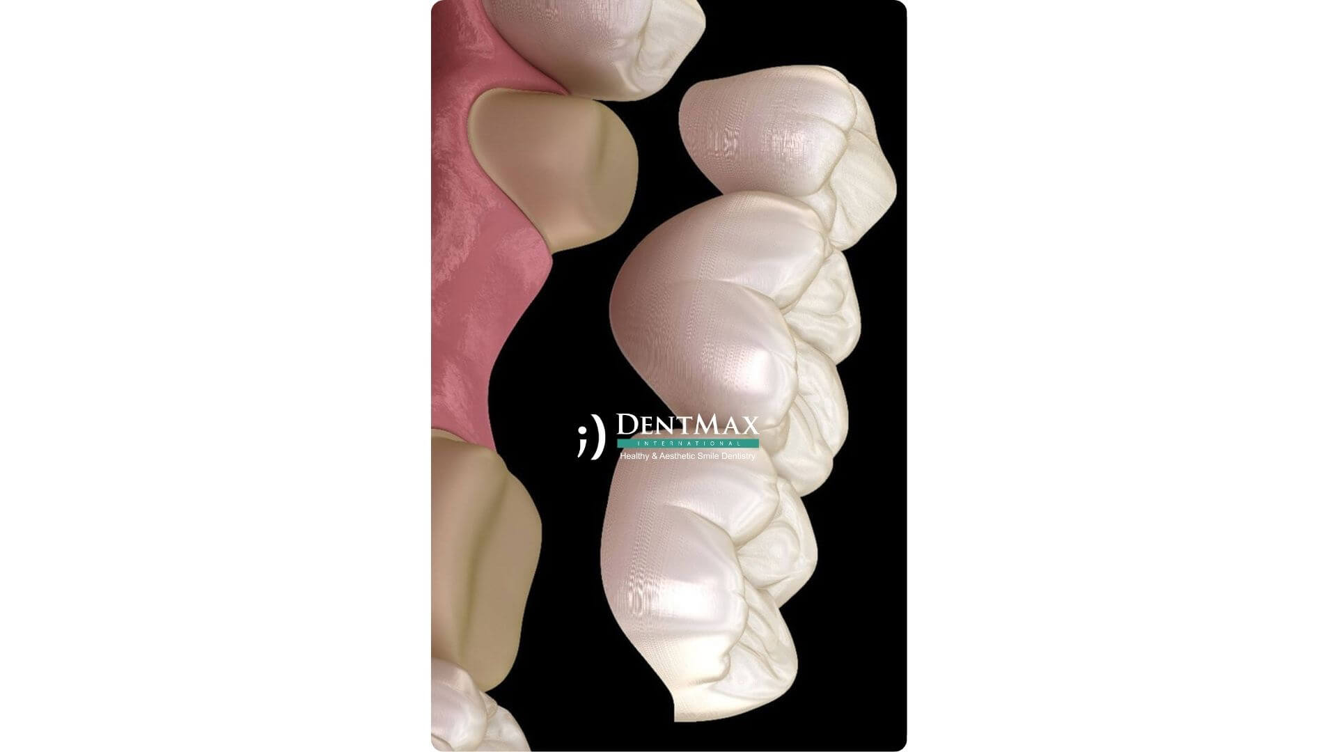Dentmax Banner
