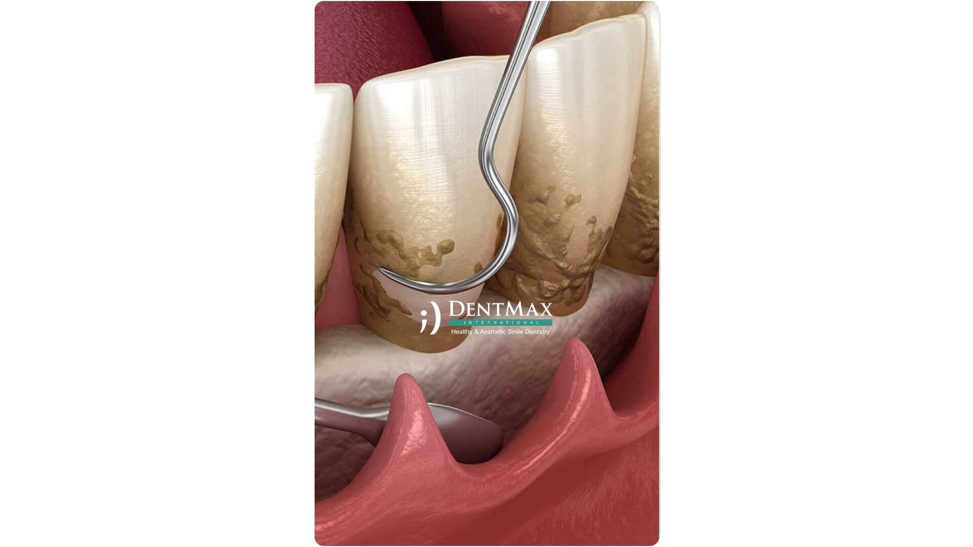 Dentmax Banner
