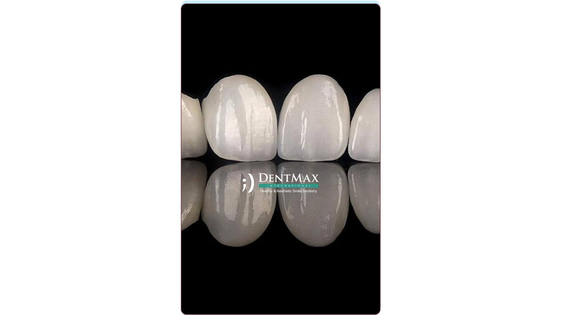 Dentmax Banner