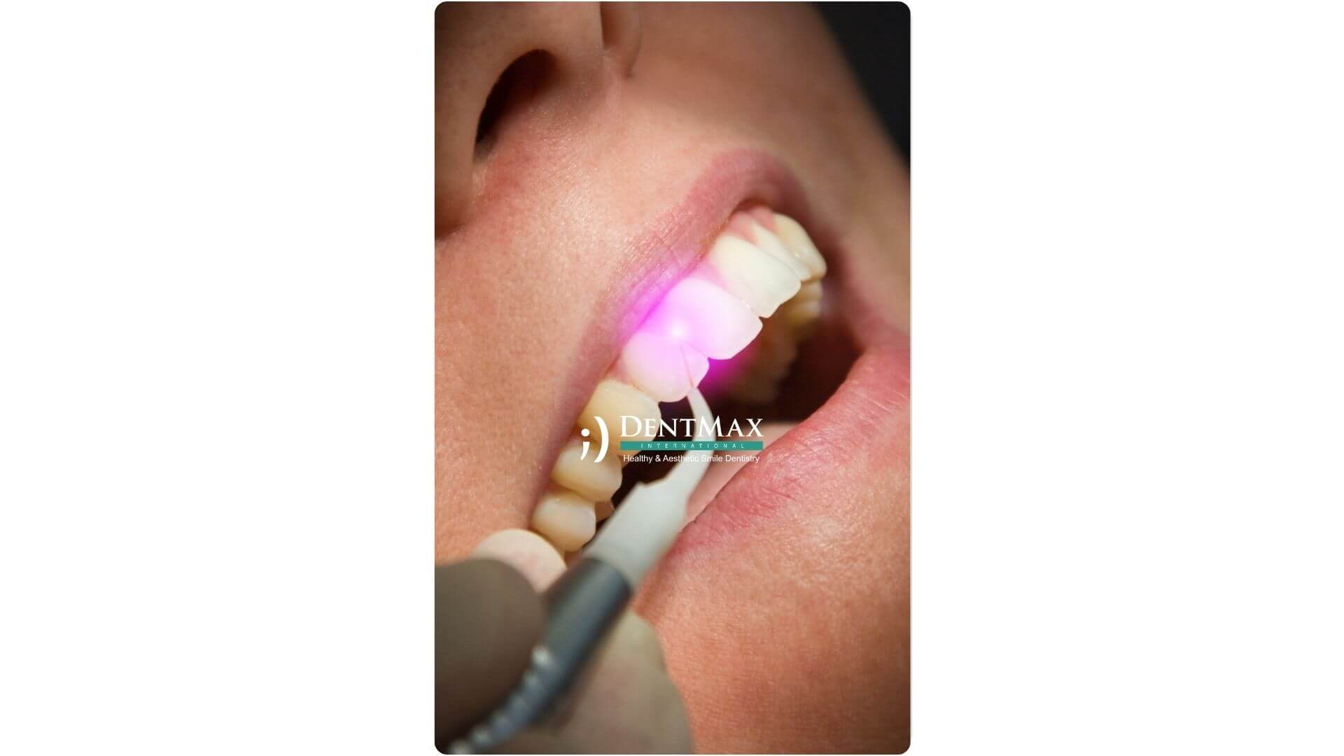 Dentmax Banner