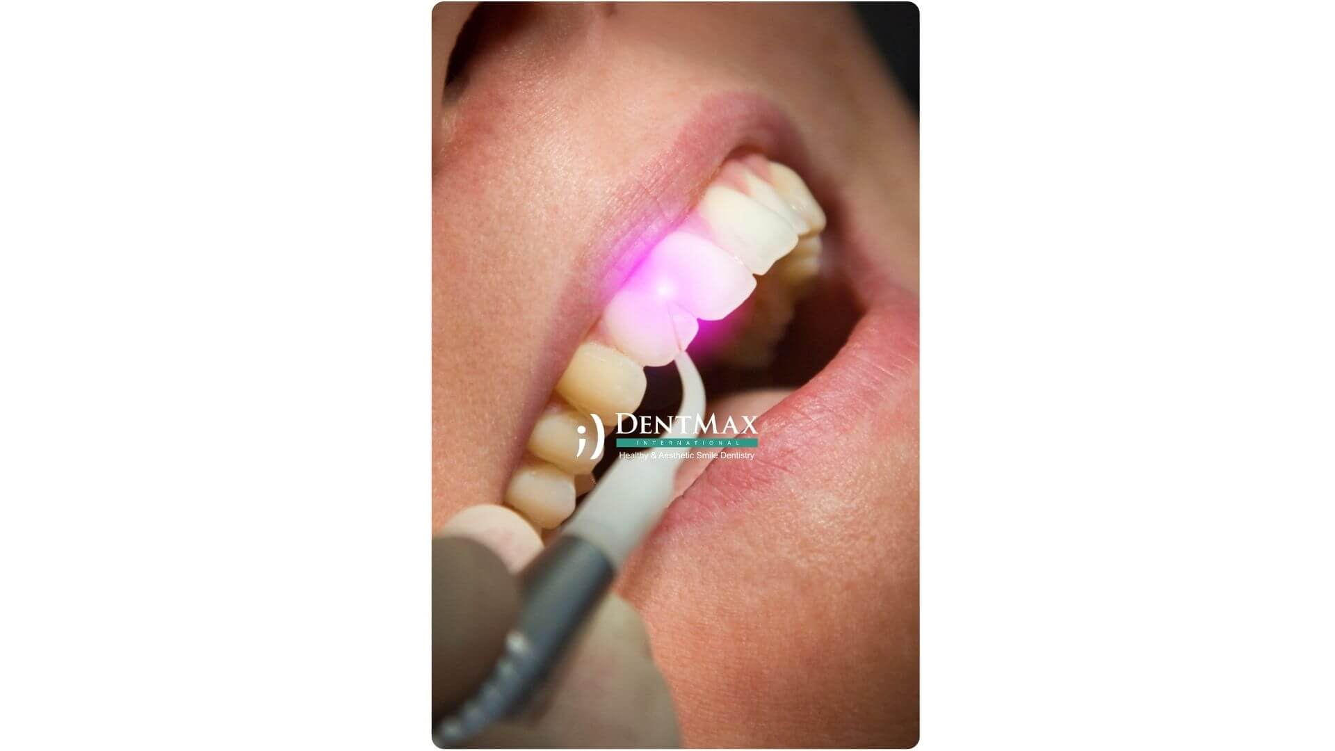 Dentmax Banner
