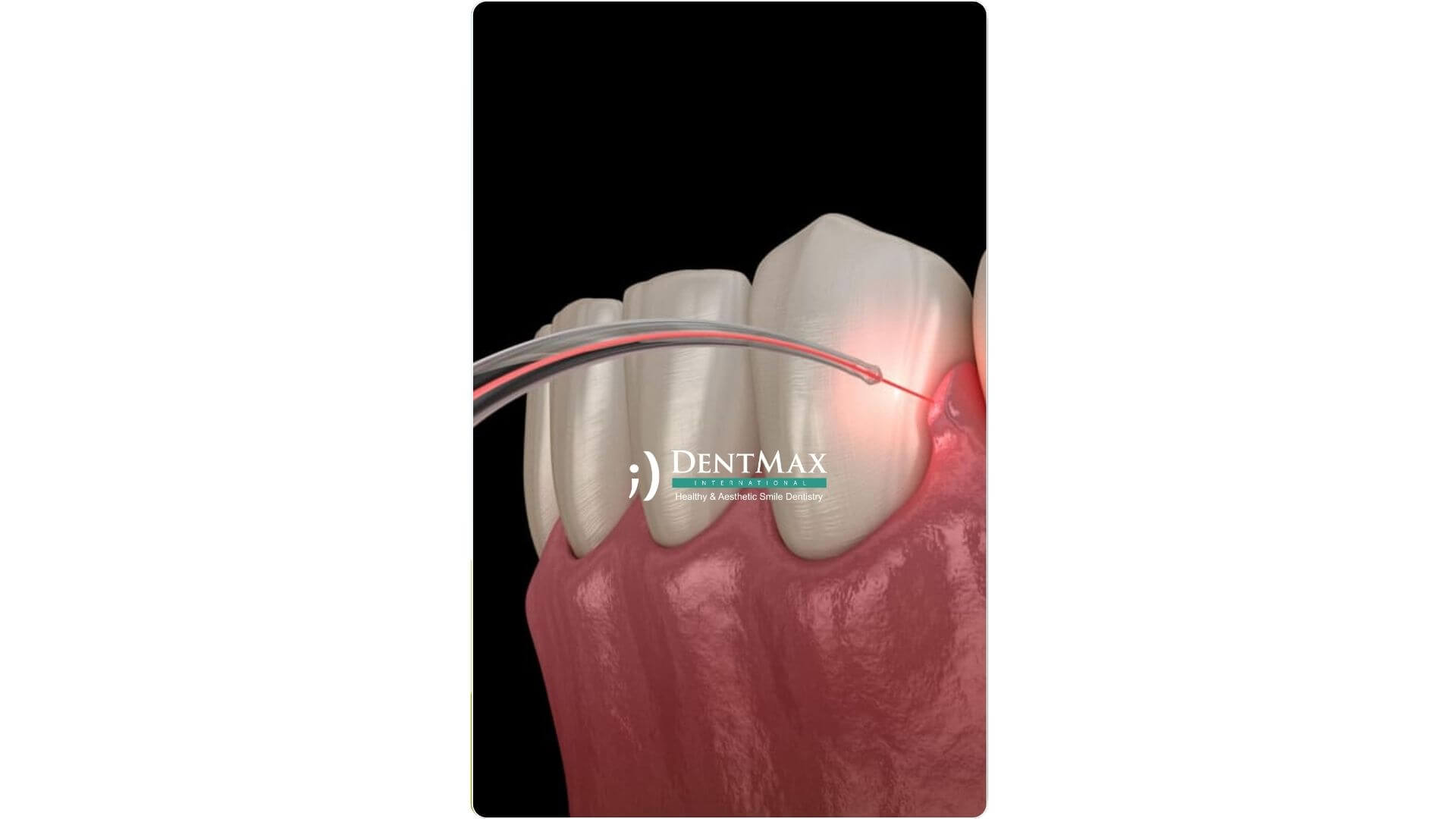 Dentmax Banner