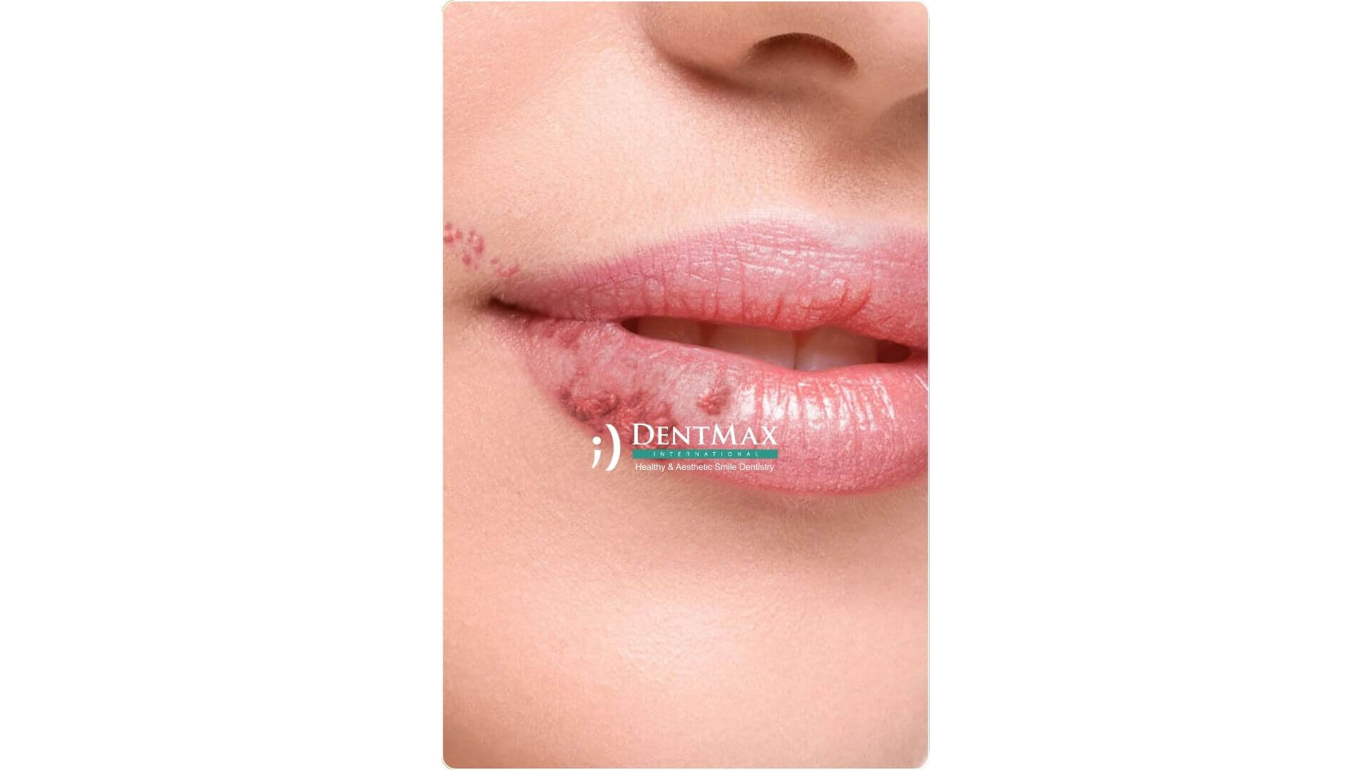 Dentmax Banner