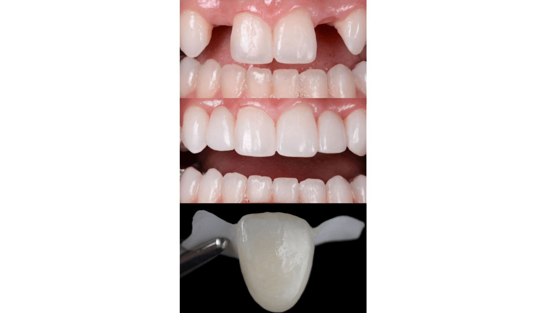 Dentmax Banner