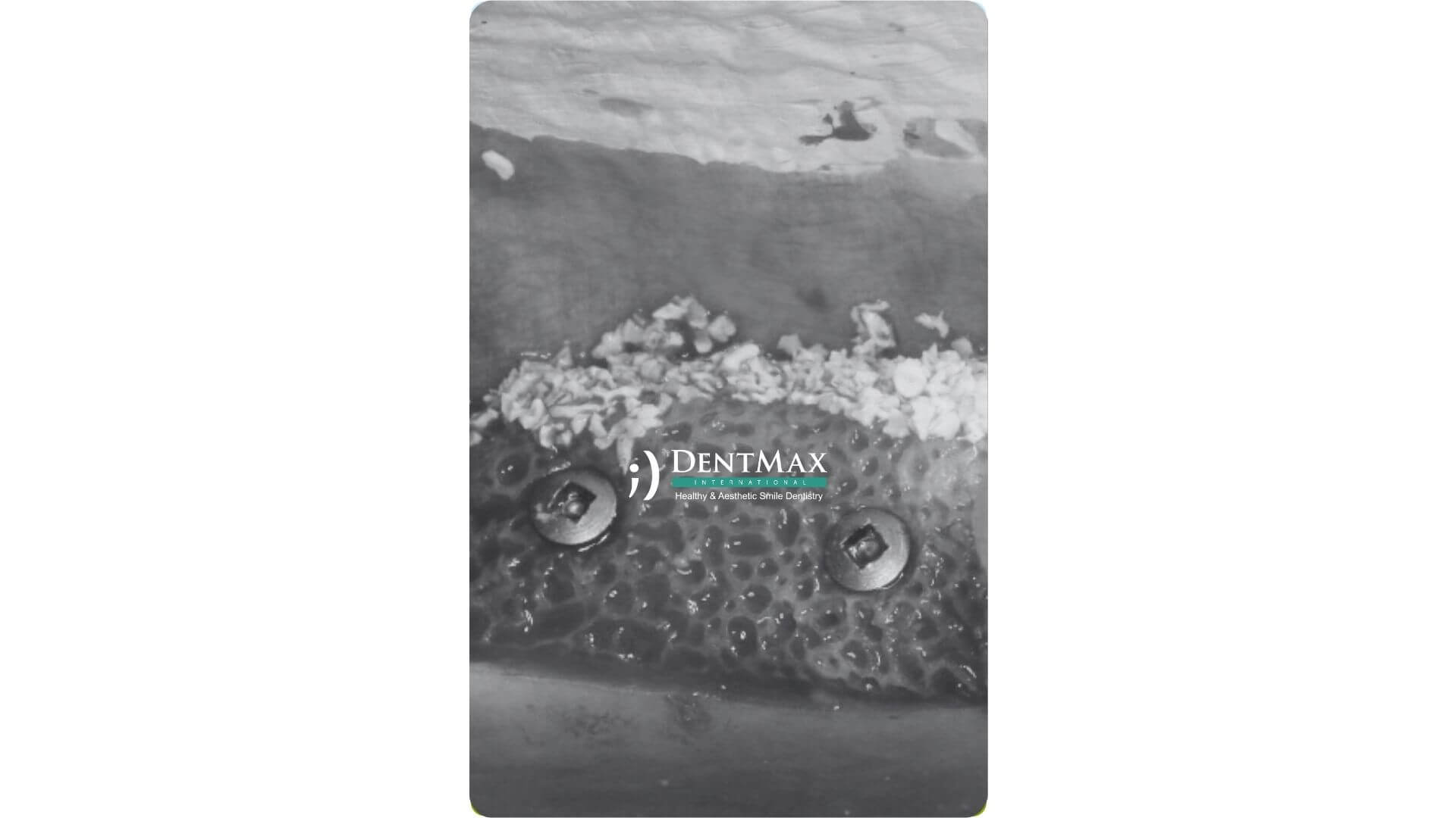Dentmax Banner