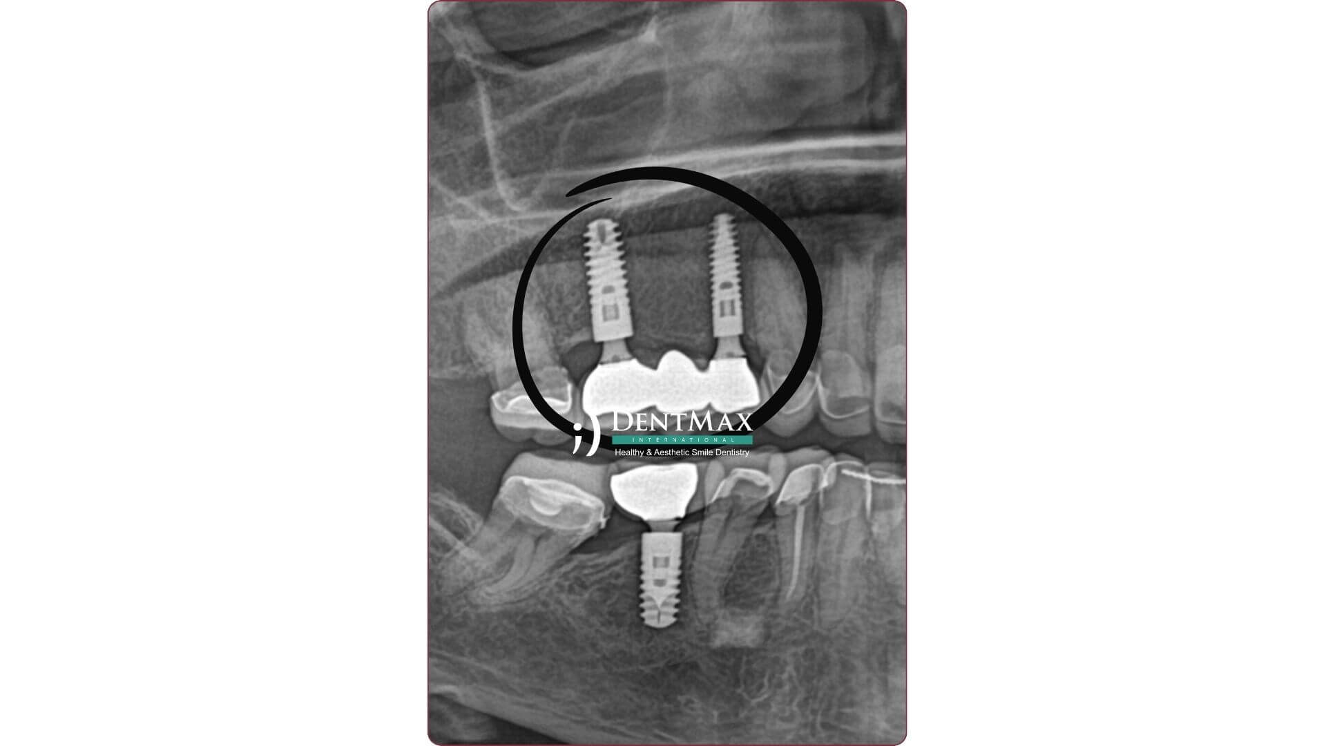 Dentmax Banner
