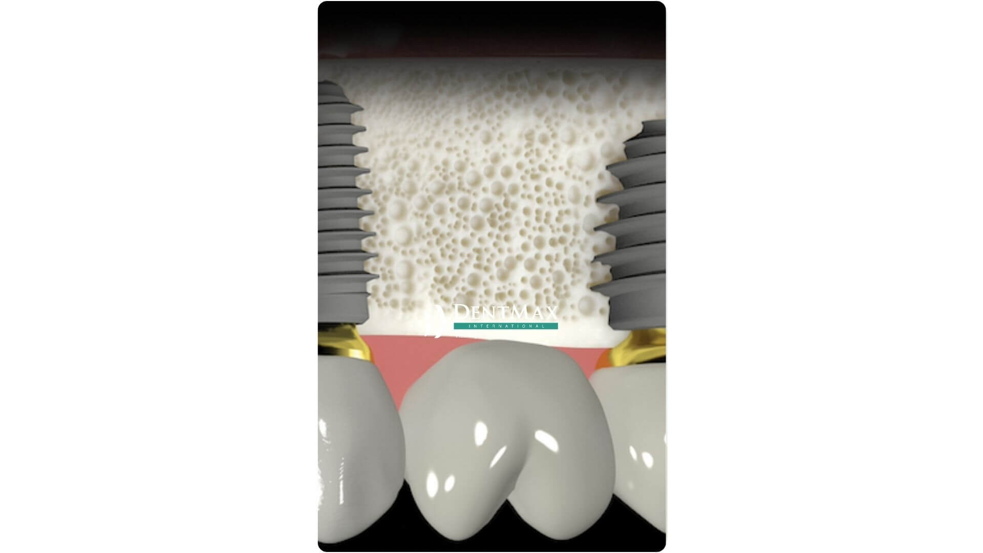 Dentmax Banner