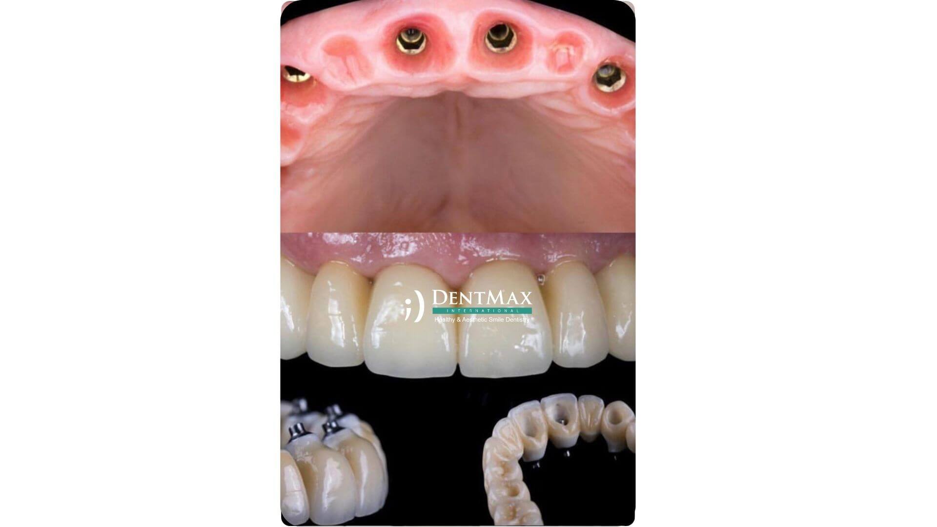 Dentmax Banner