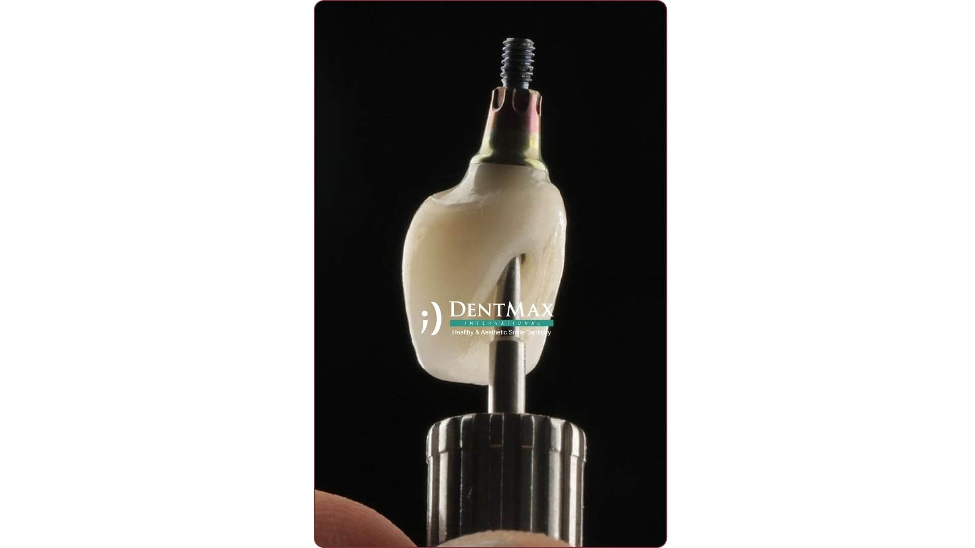 Dentmax Banner