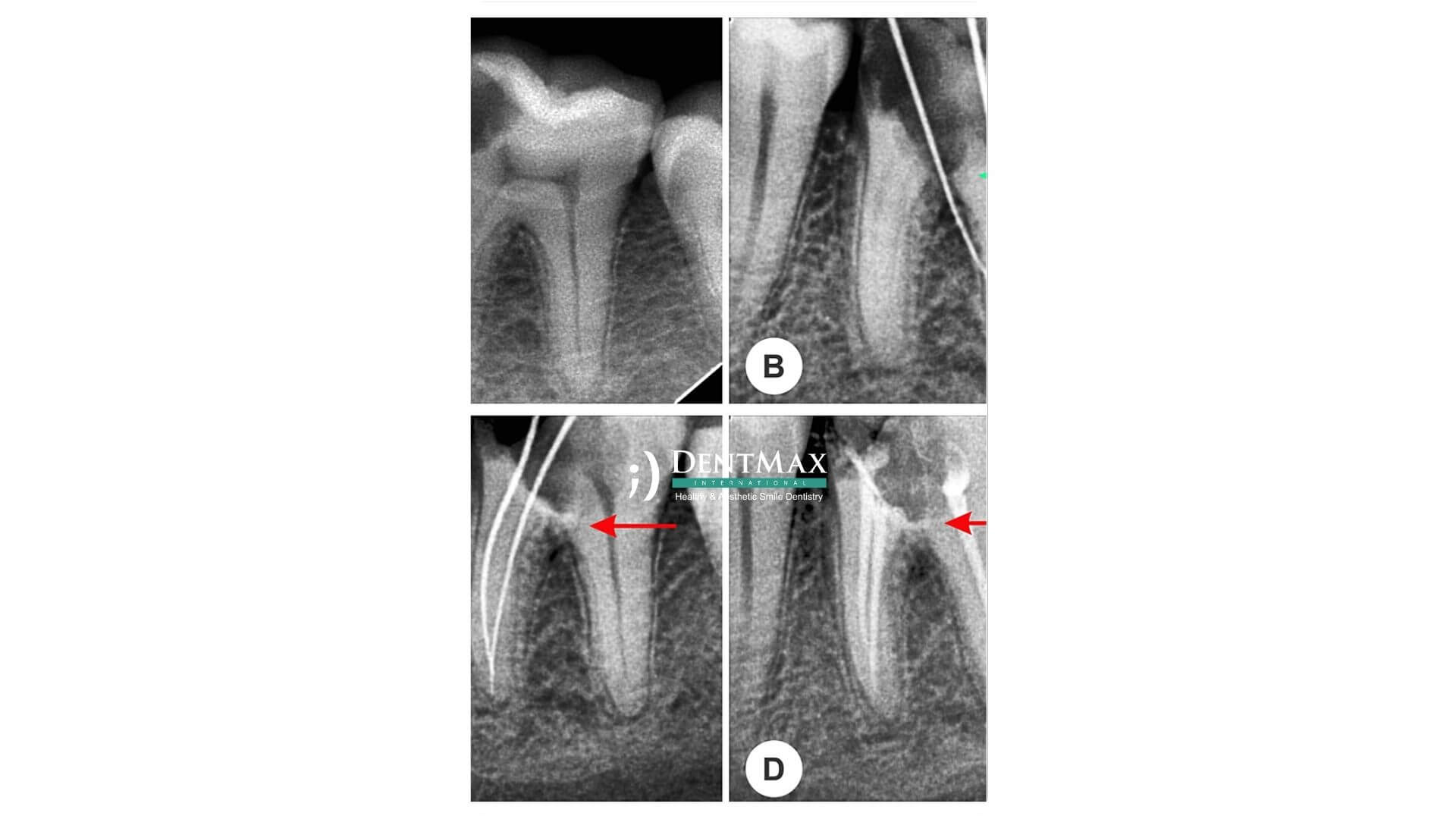 Dentmax Banner