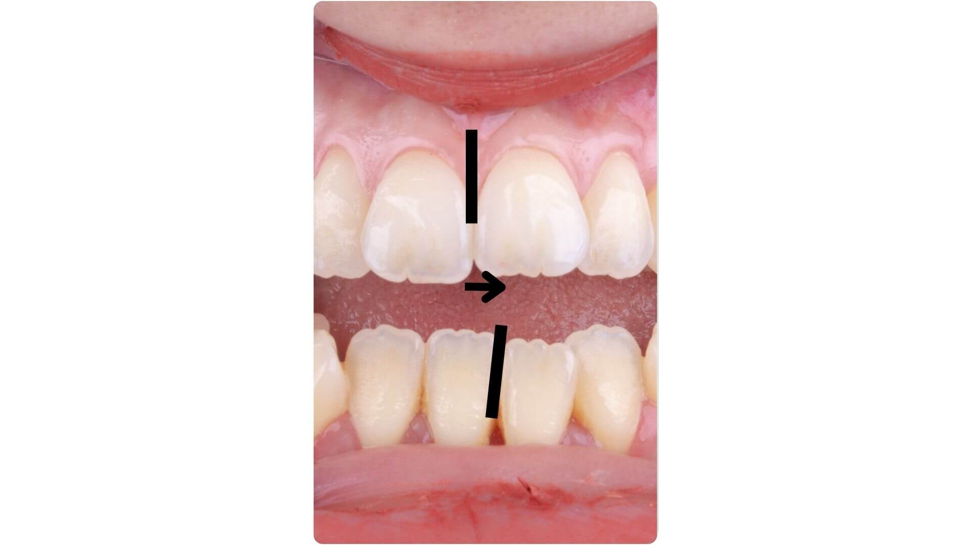 Dentmax Banner