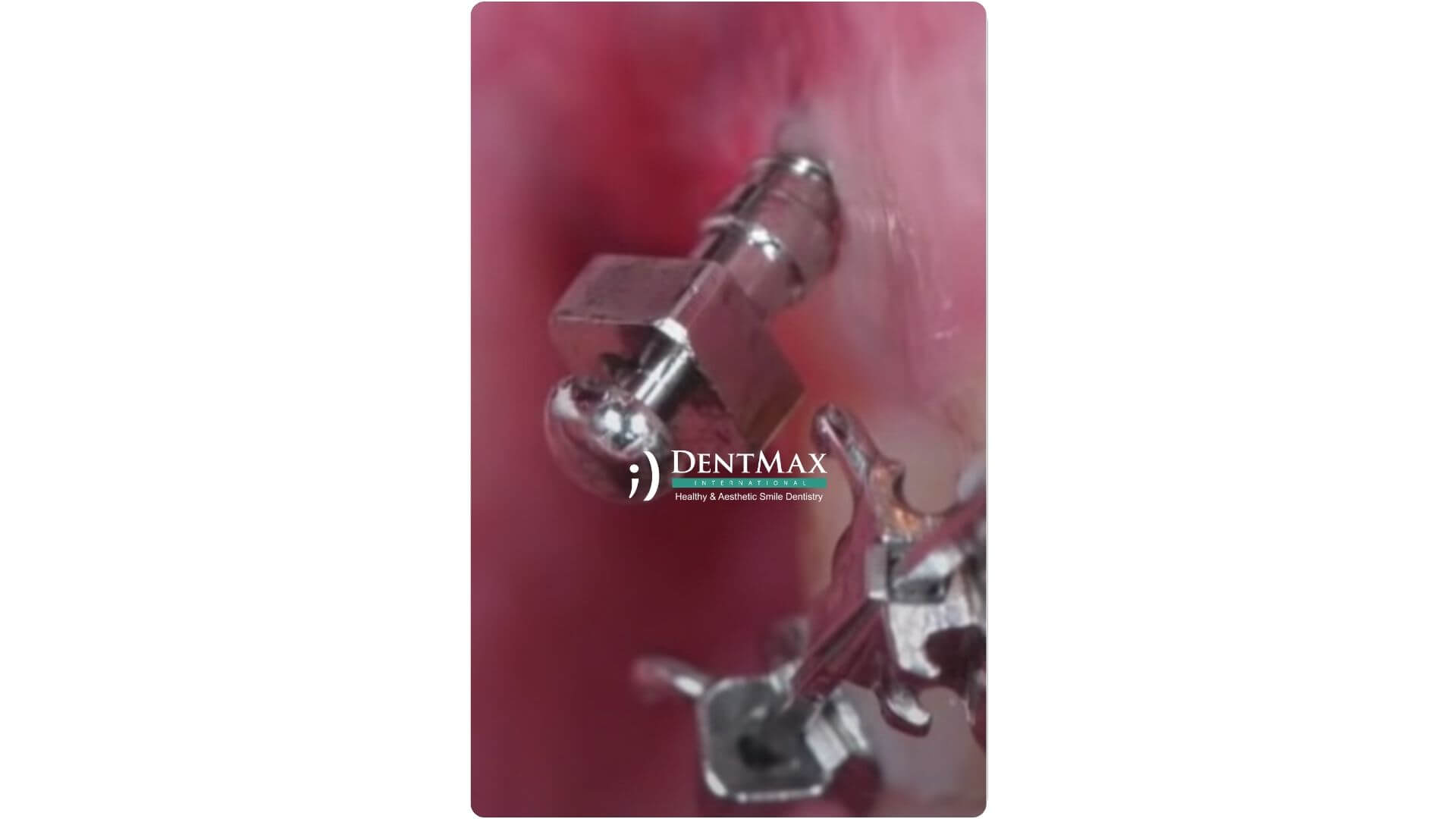 Dentmax Banner