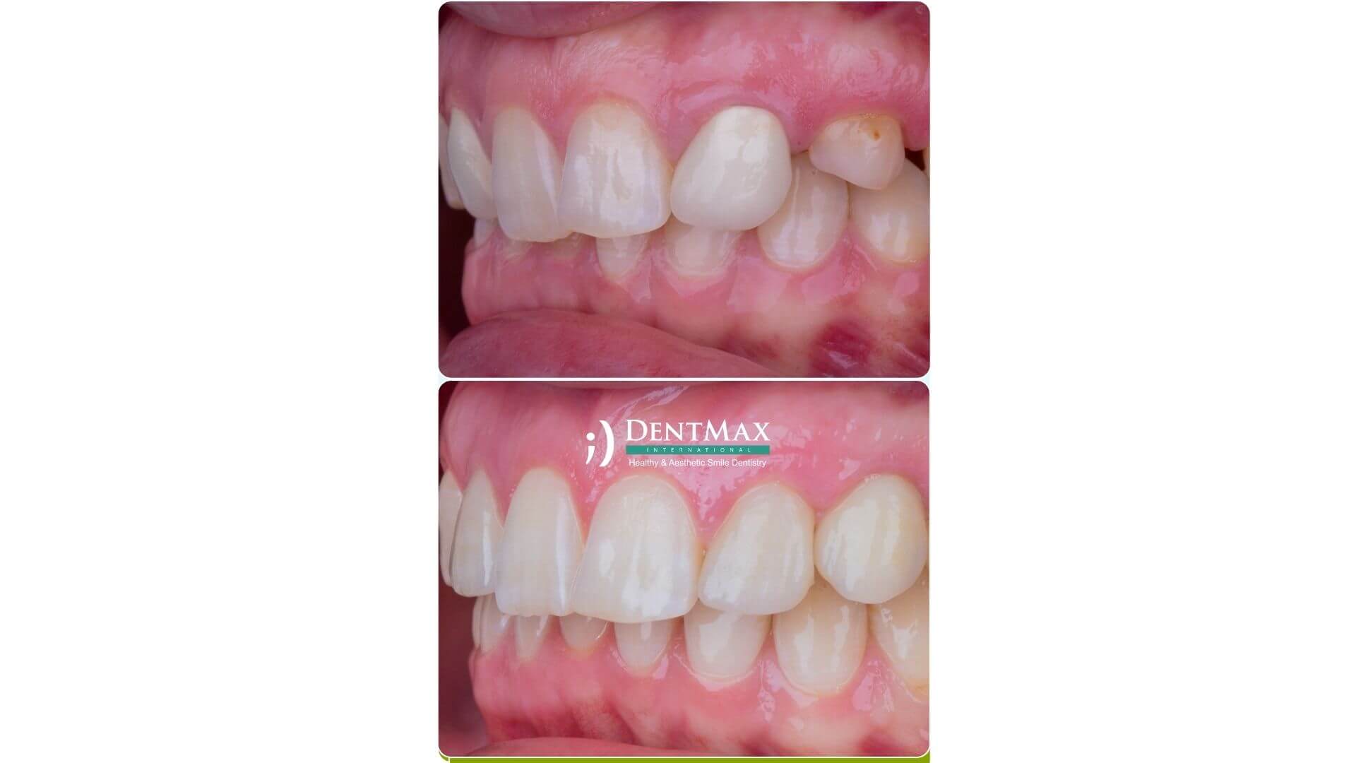 Dentmax Banner