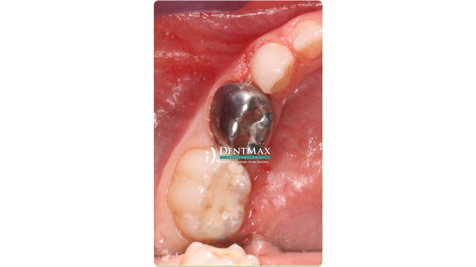 Dentmax Banner