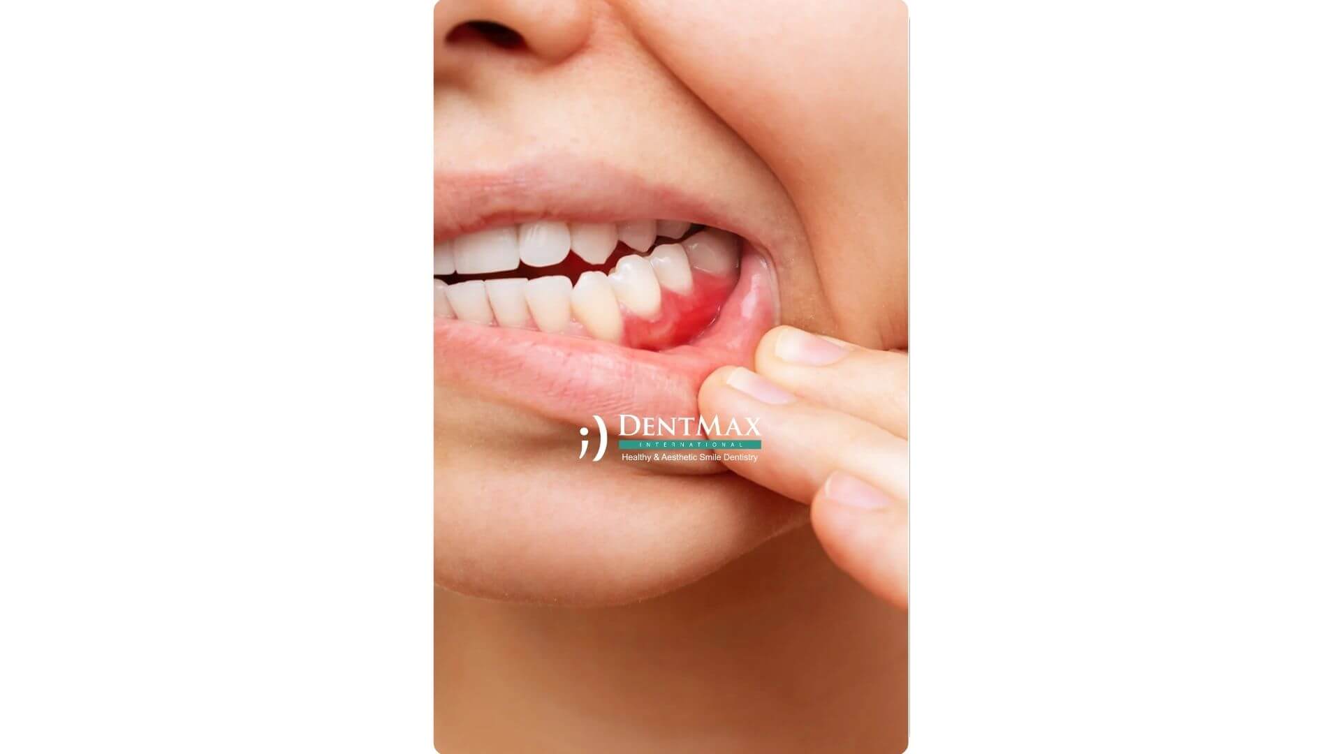 Dentmax Banner