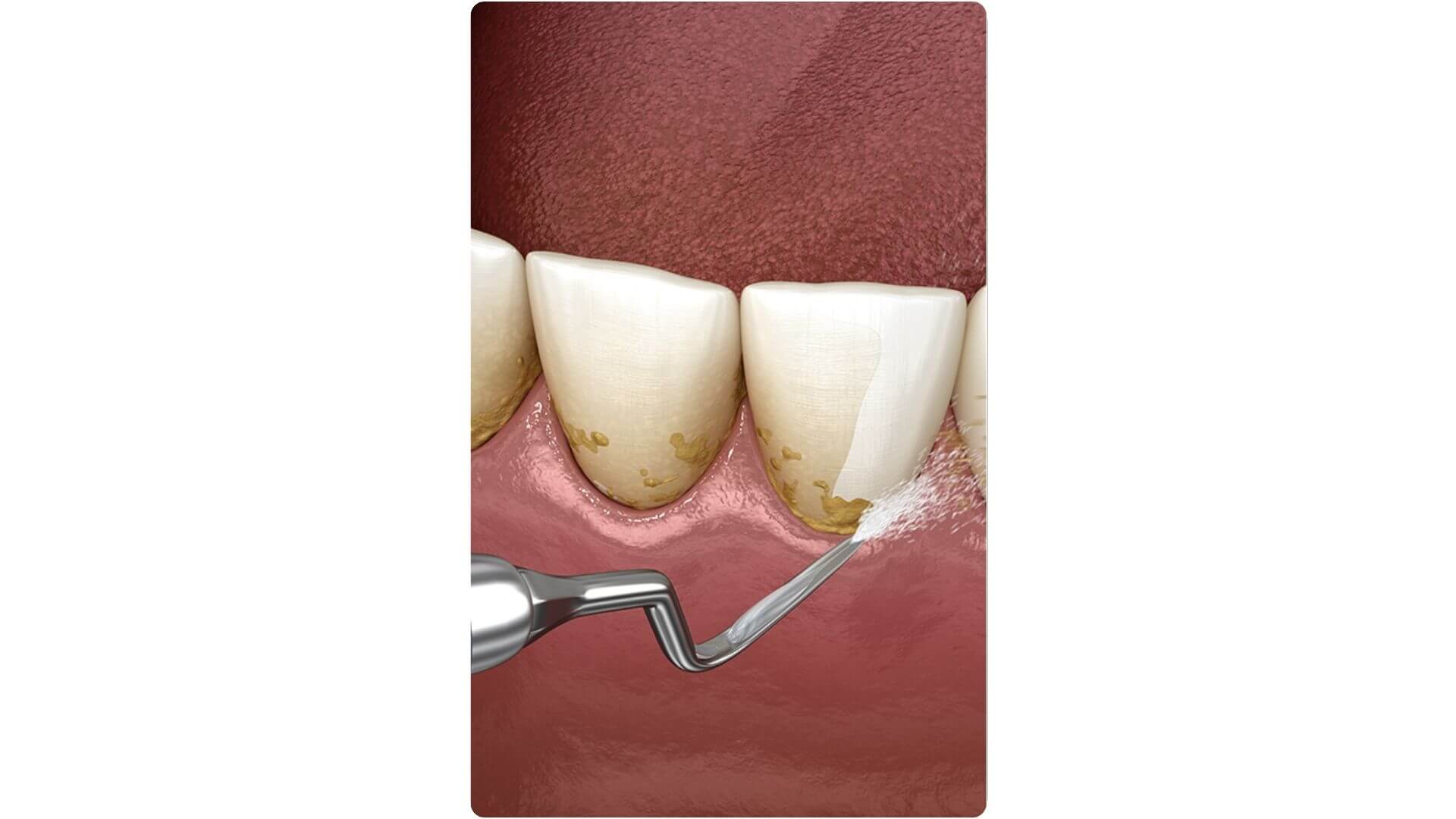 Dentmax Banner