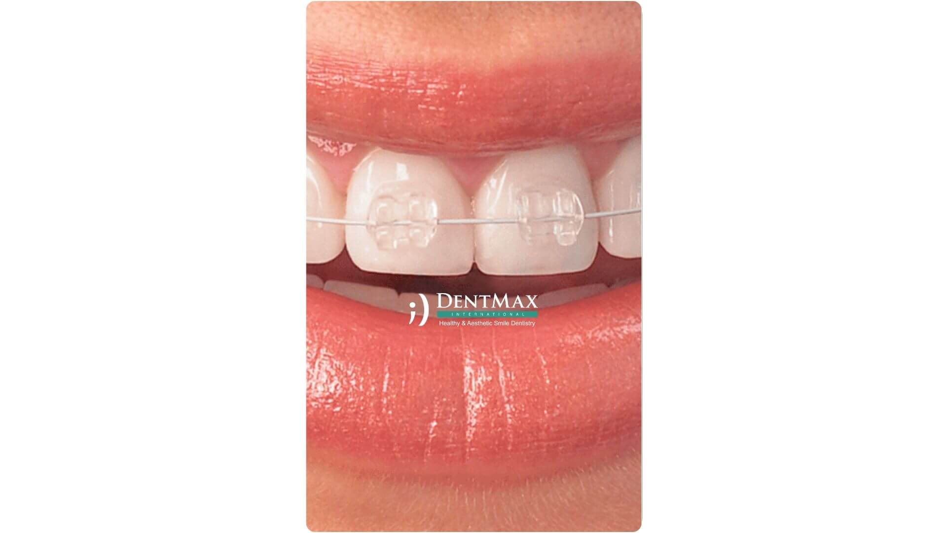 Dentmax Banner
