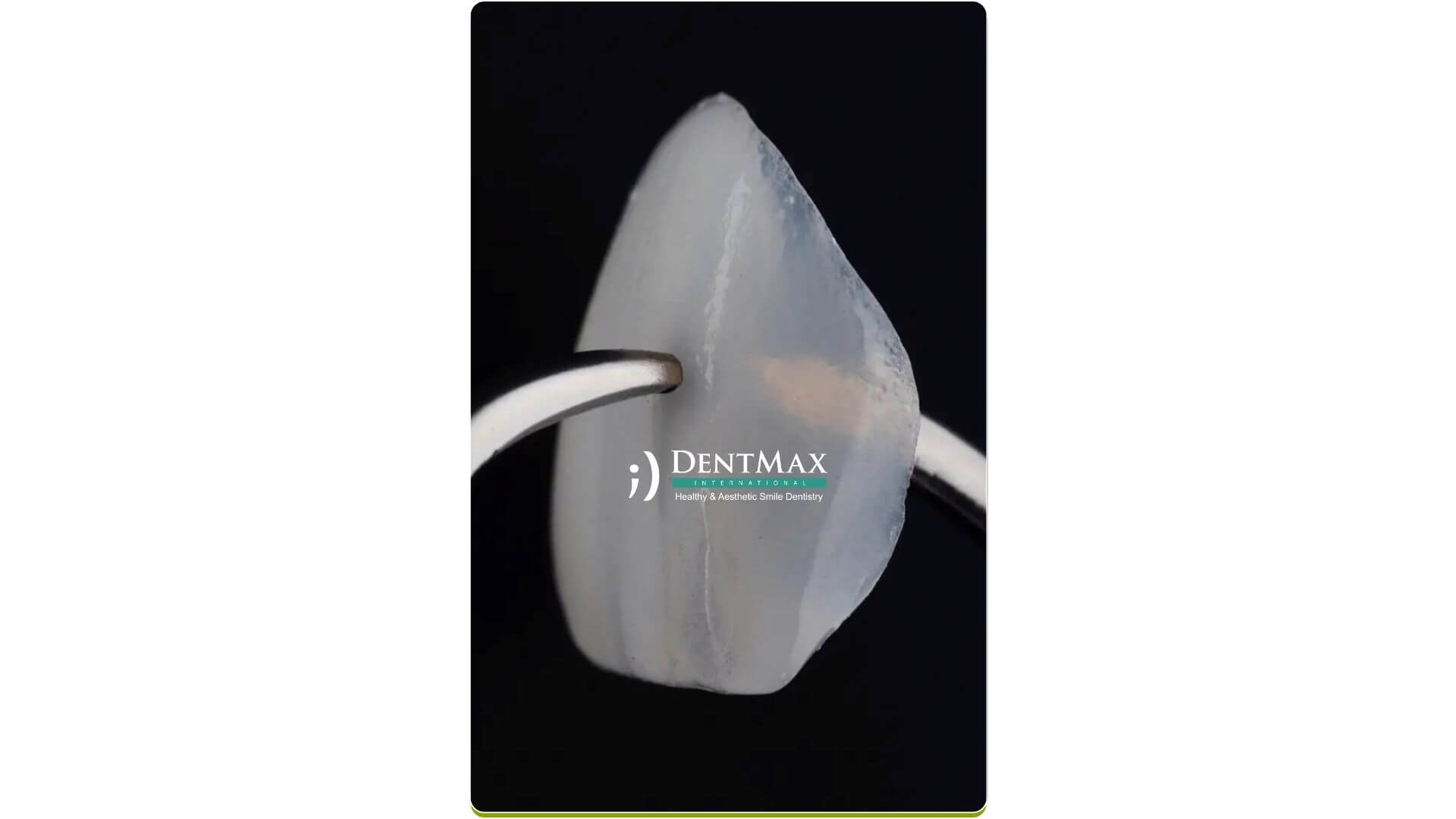 Dentmax Banner