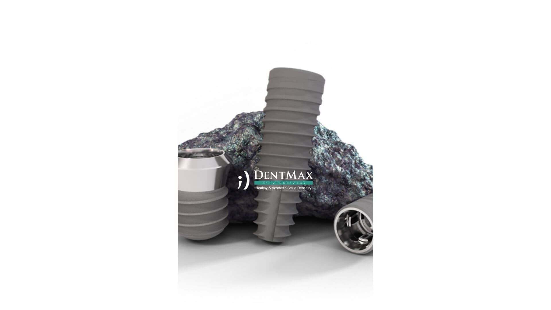 Dentmax Banner