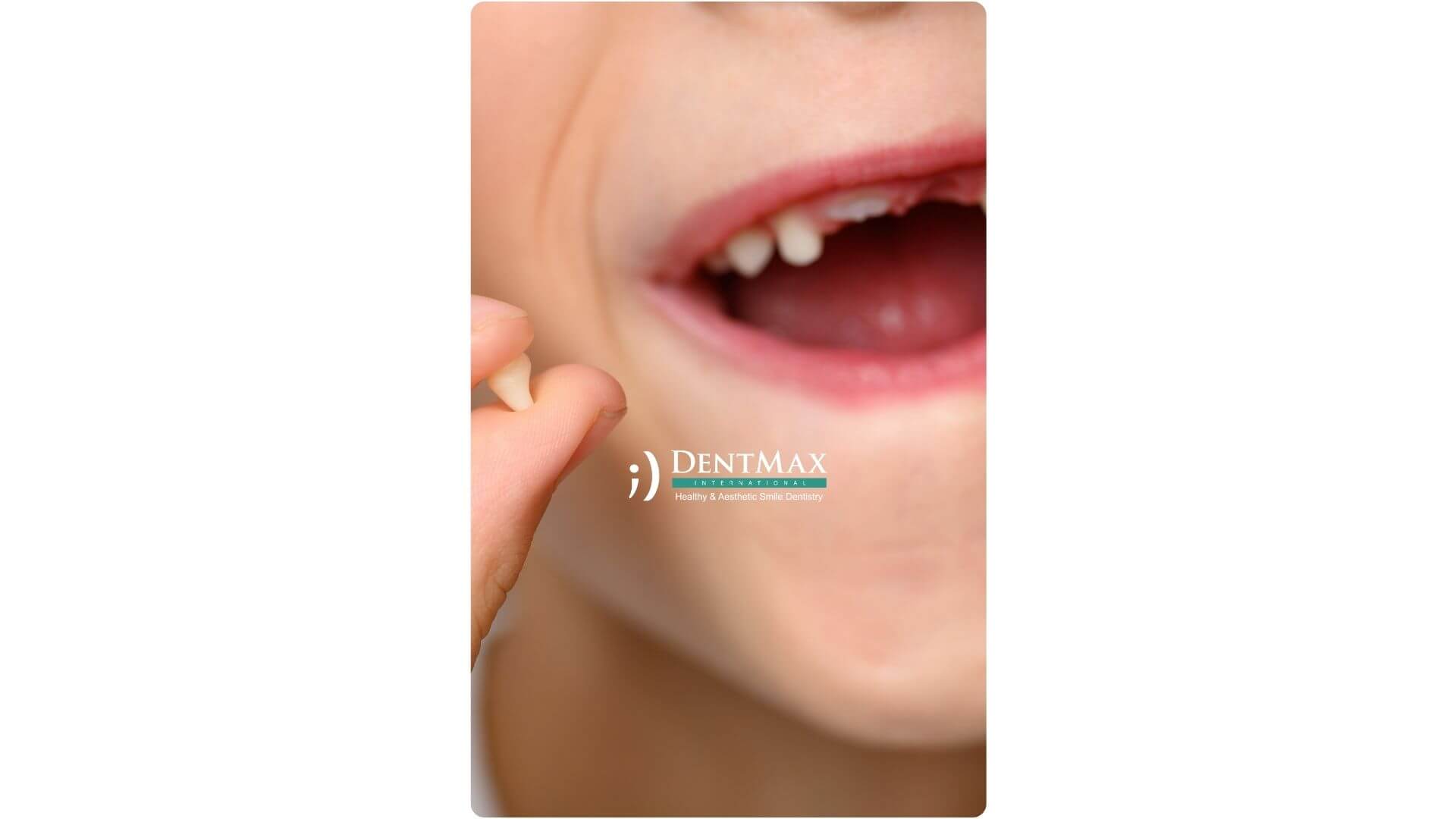 Dentmax Banner