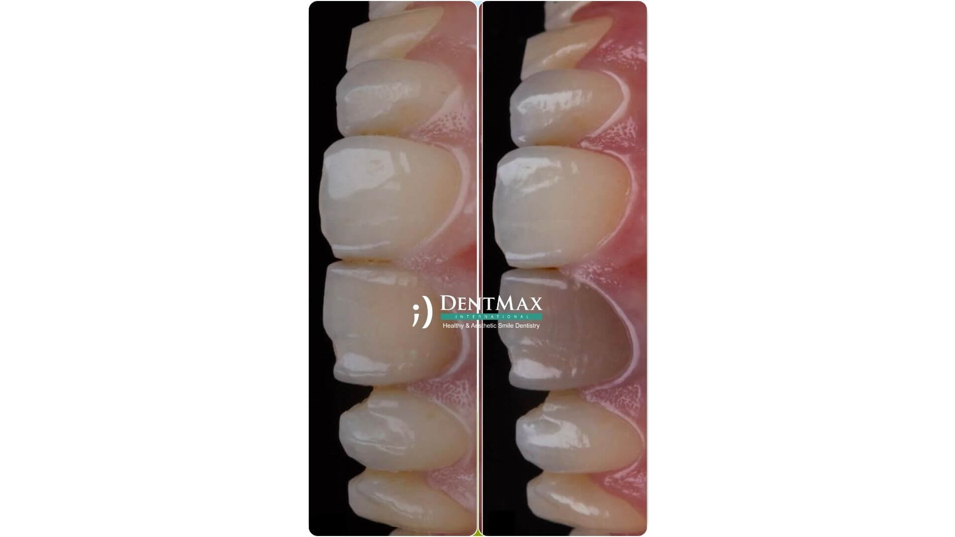 Dentmax Banner
