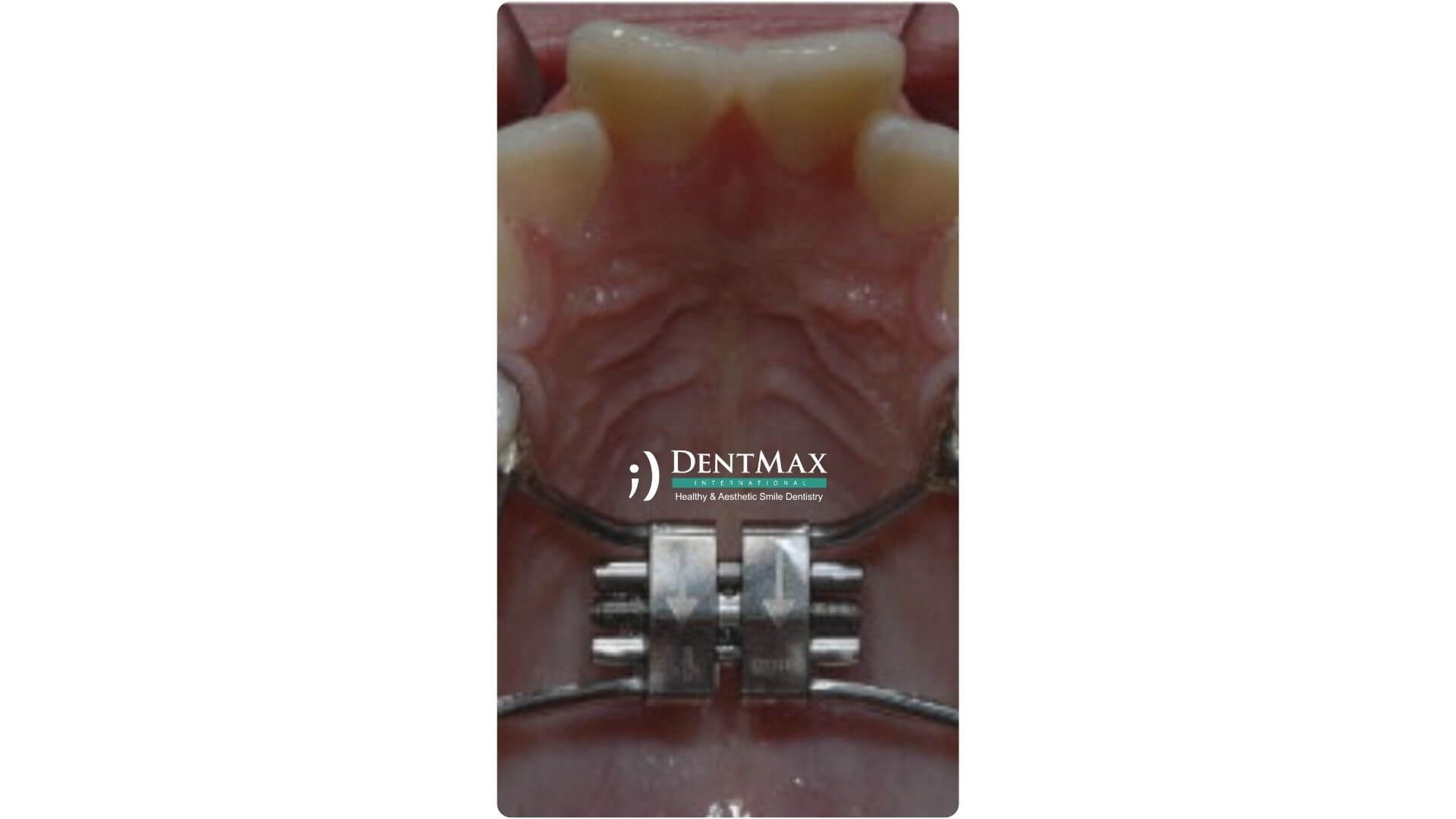 Dentmax Banner