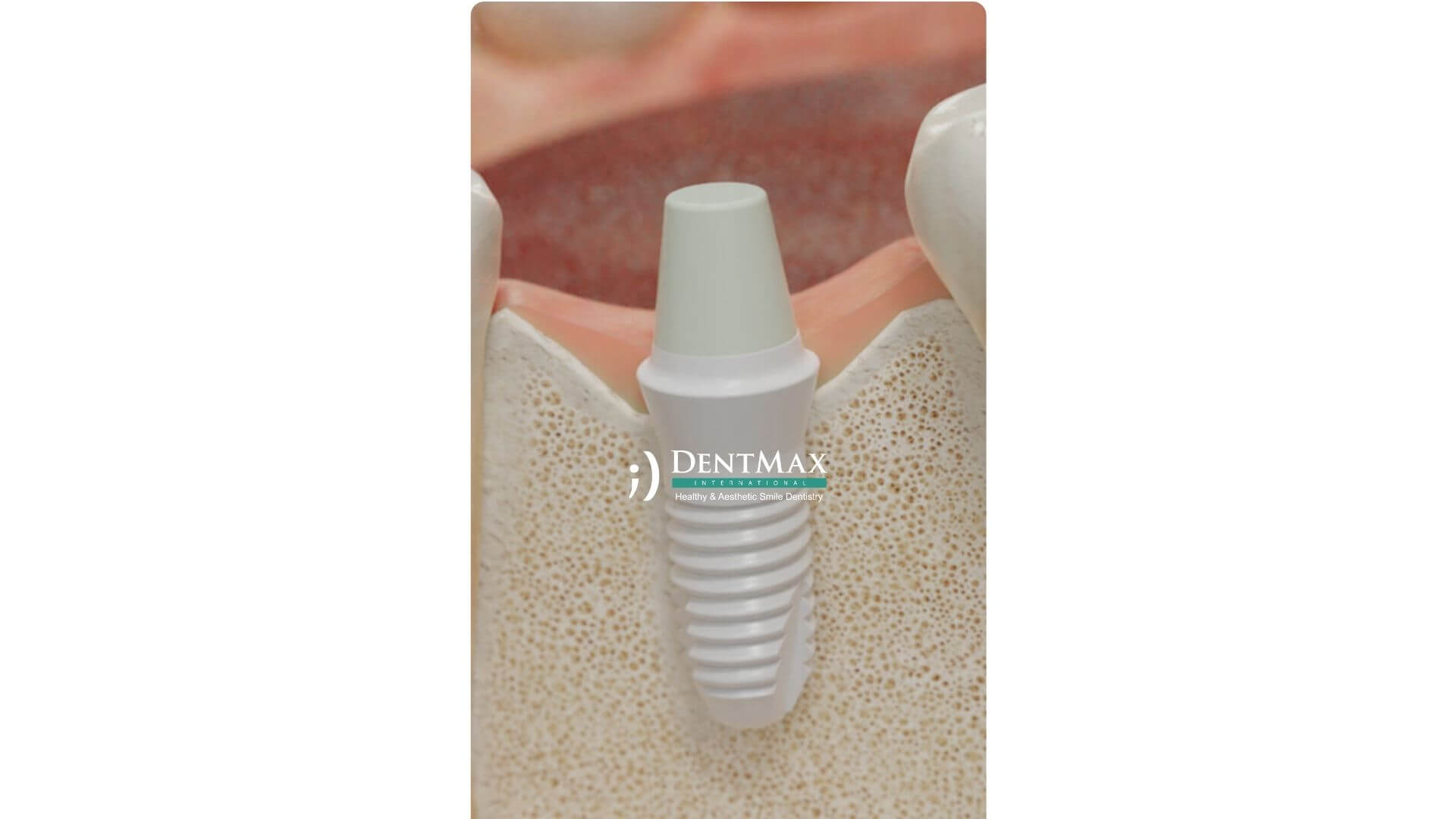 Dentmax Banner