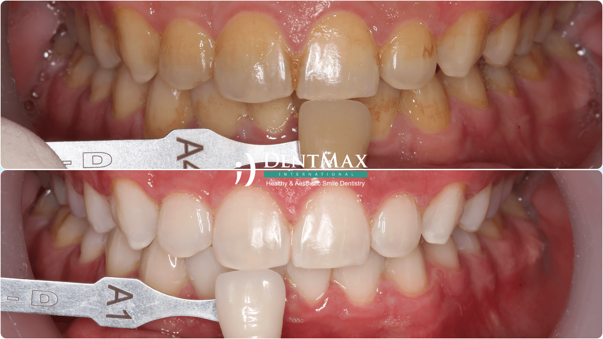 Dentmax Tedaviler