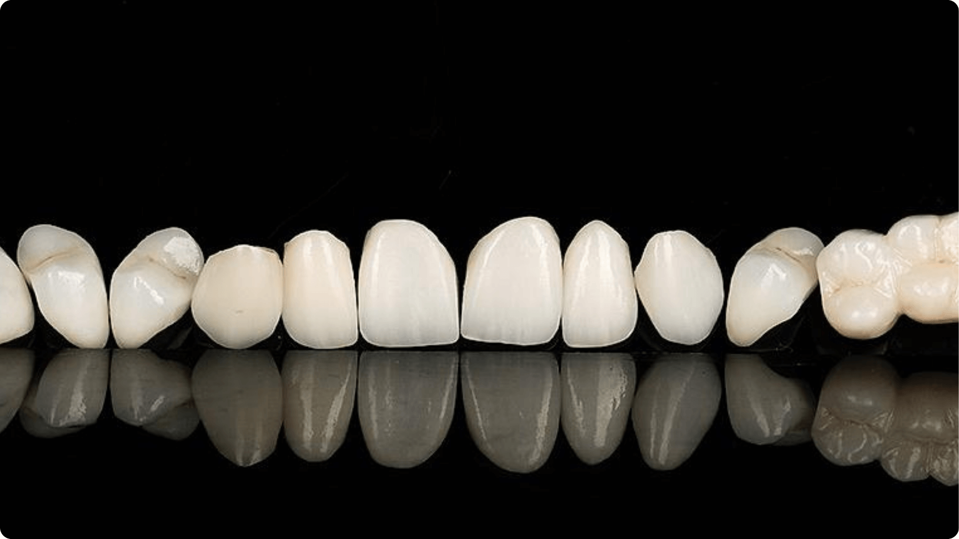 Dentmax Tedaviler