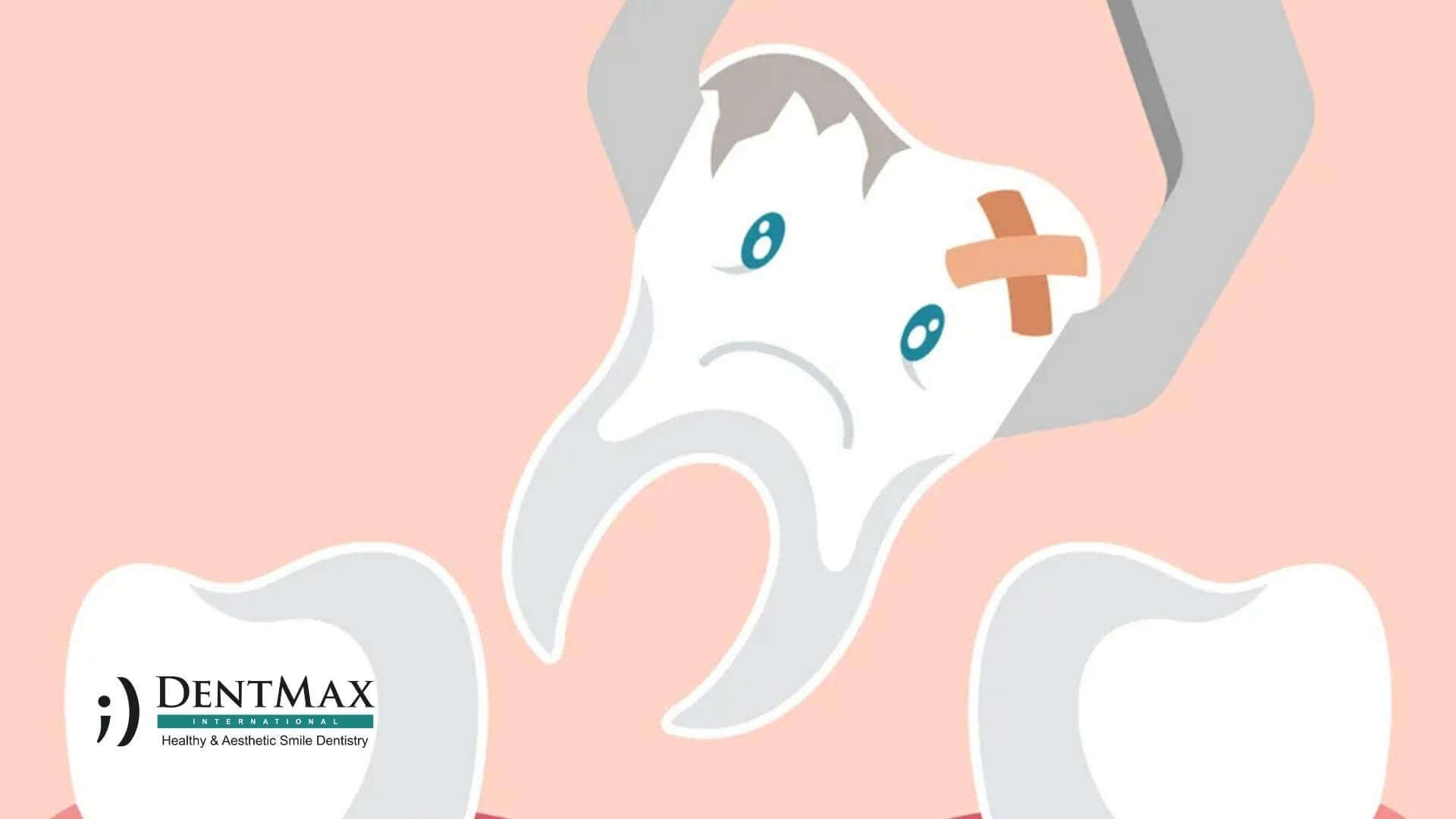 Dentmax Tedaviler