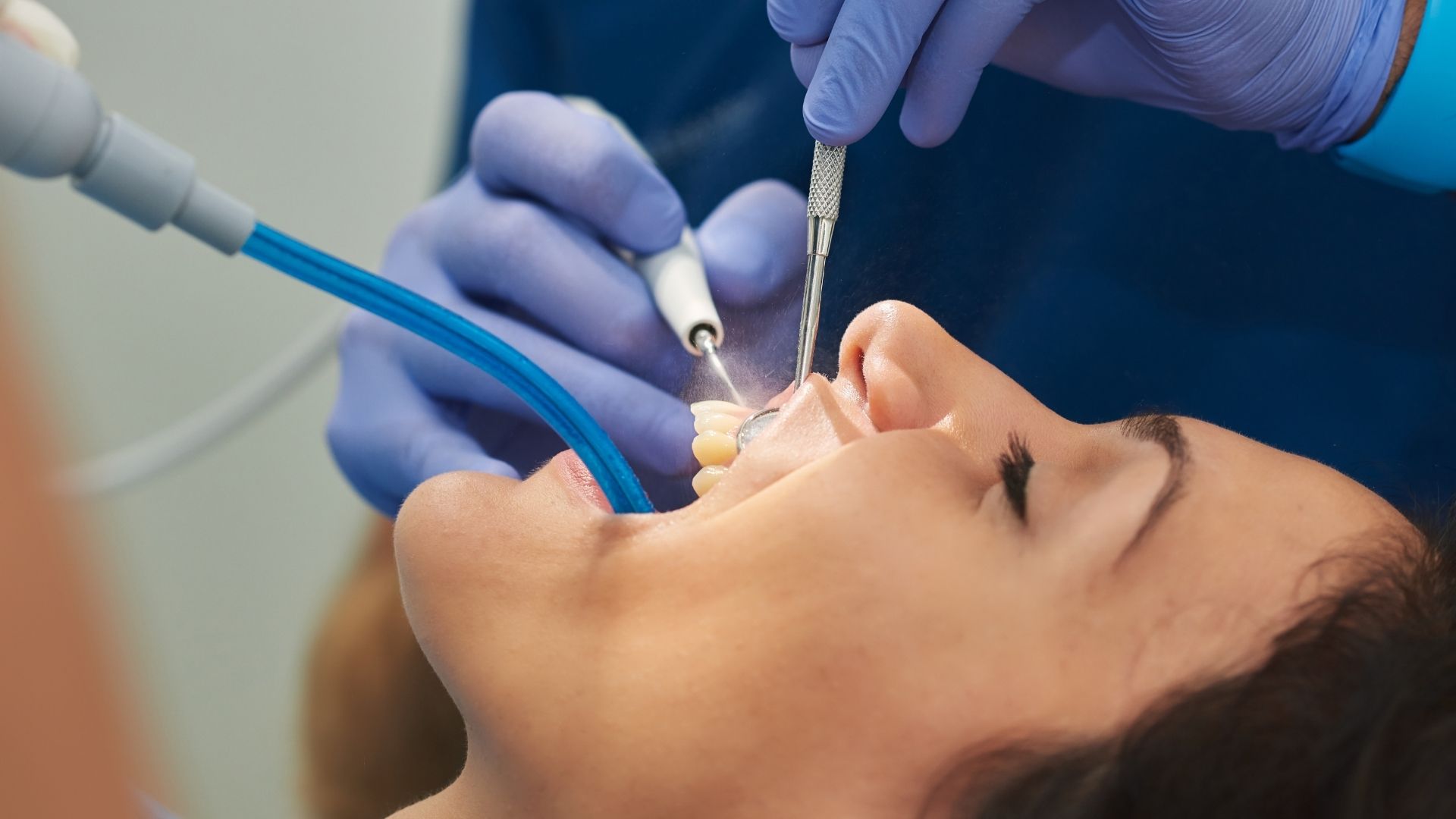 Dentmax Tedaviler