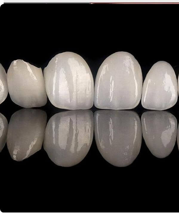 جهاز CEREC CAD/CAM للتصميم والطحن | عيادة أسنان إسطنبول – DentMax