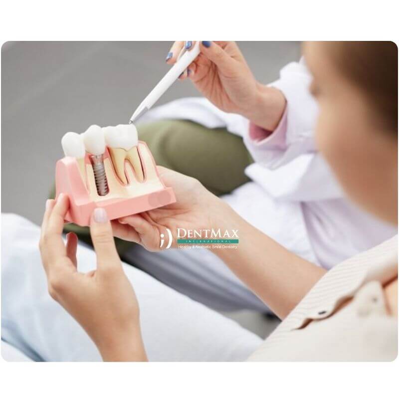 Dentmax