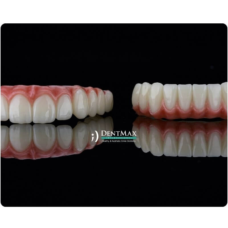 Dentmax
