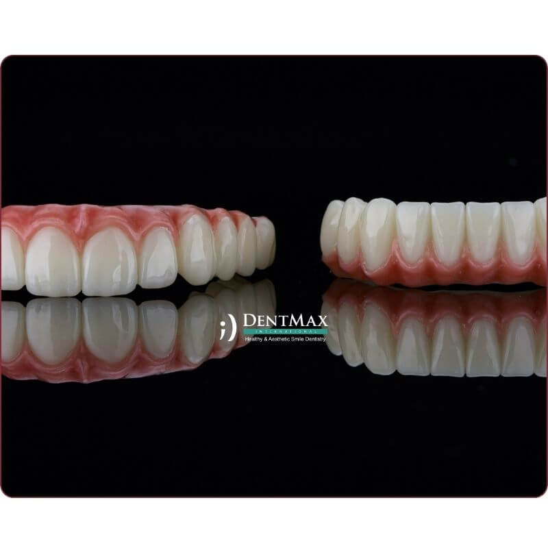 Dentmax