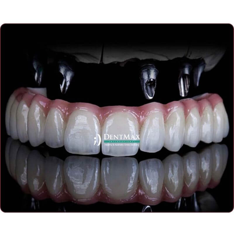 Dentmax