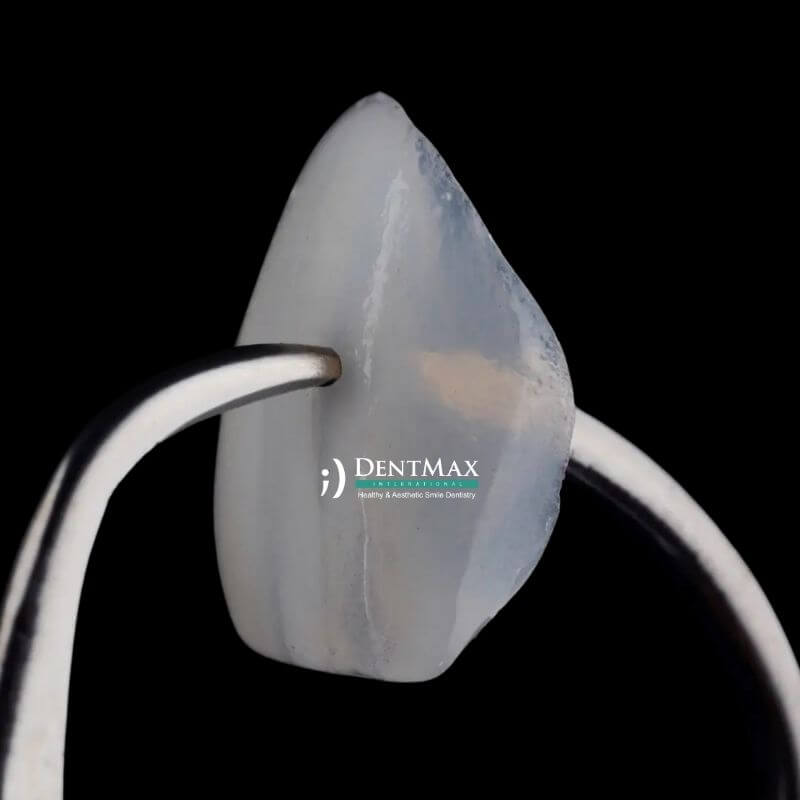 Dentmax