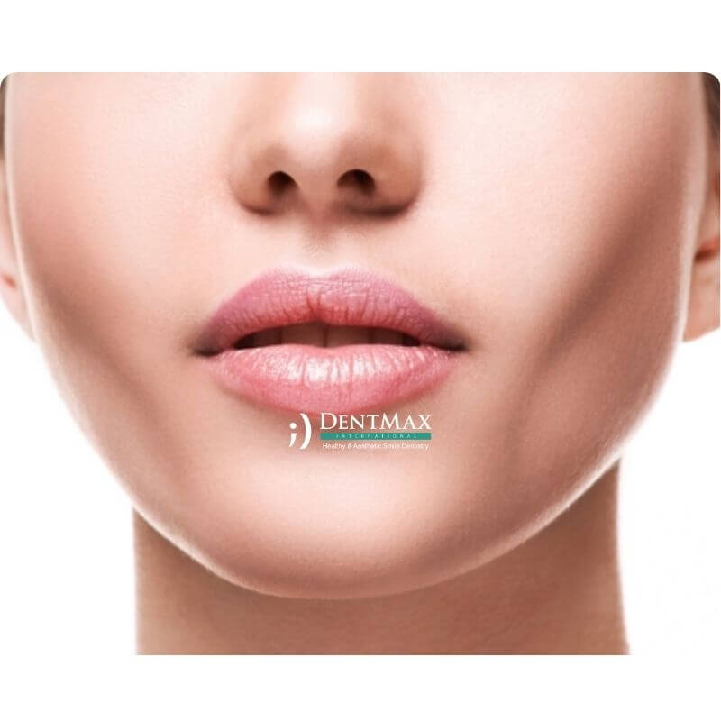 Dentmax