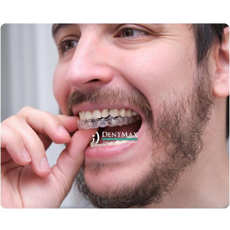 Dentmax