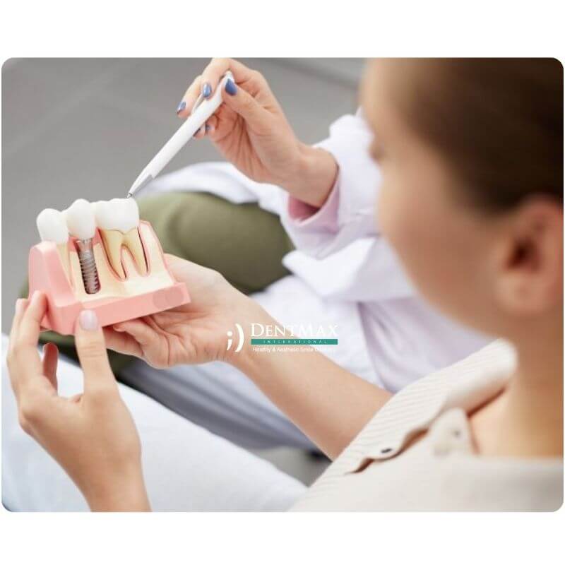 Dentmax