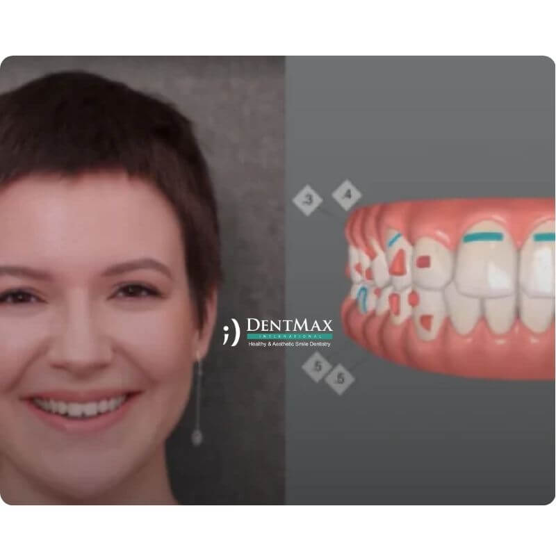 Dentmax